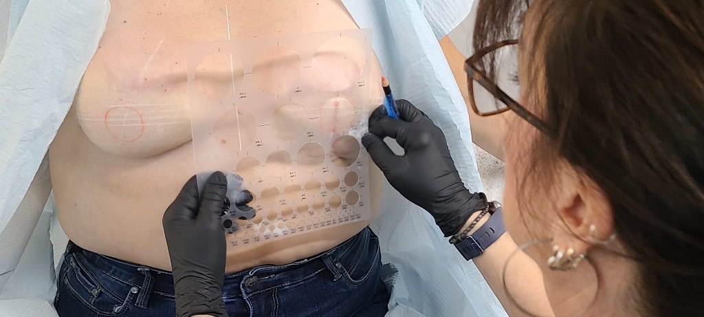 Precise Clinical Mapping